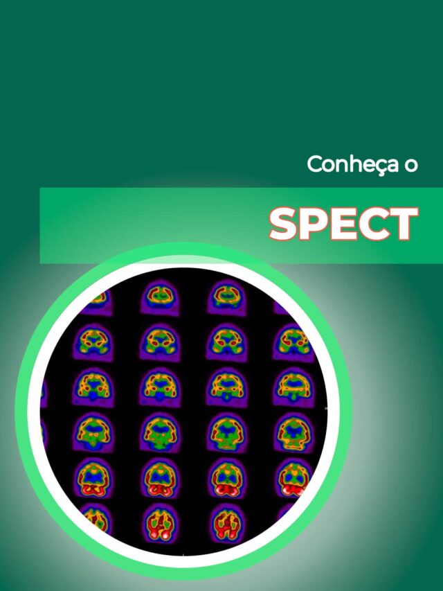 SPECT